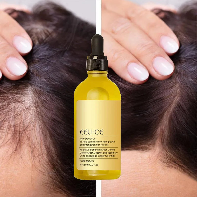 Hair Growth Products Prevent Hair Loss Essential Oil Fast Growing Anti-Drying Scalp Treatment Repair Beauty Health for Men Women