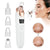 Electric Pore Cleaner Facial Beauty Device - Twin suppliers 