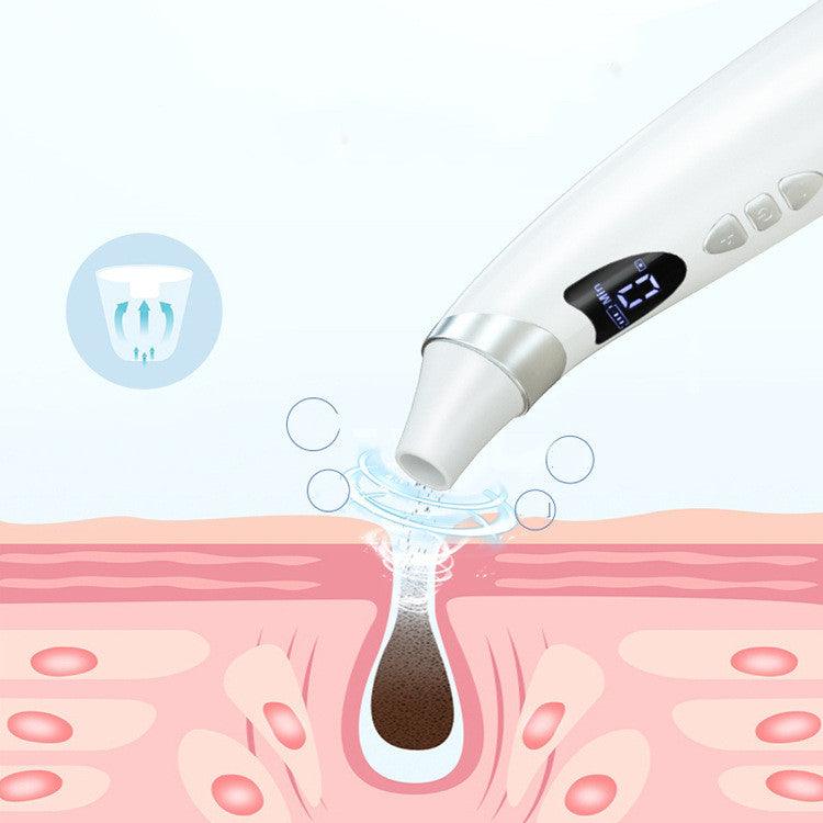 Electric Visual Blackhead Suction Instrument Household Cleansing Pore Cleaner For Skin Equipment Skin Care Tool - Twin suppliers 