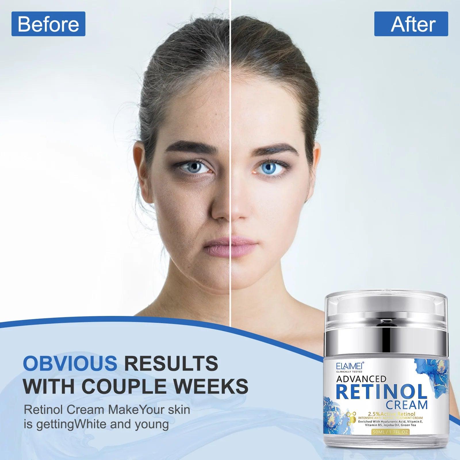 Retinol Face Cream Anti-wrinkle Anti-aging Moisturizing Hyaluronic Acid - Twin suppliers 